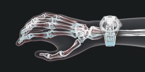 Ulysse Nardin Skeleton X: mẫu đồng hồ lộ máy độc nhất vô nhị