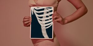 Tội nghiệp vòng eo: Bạn biết gì về kỹ thuật làm gãy vi mô các xương sườn?